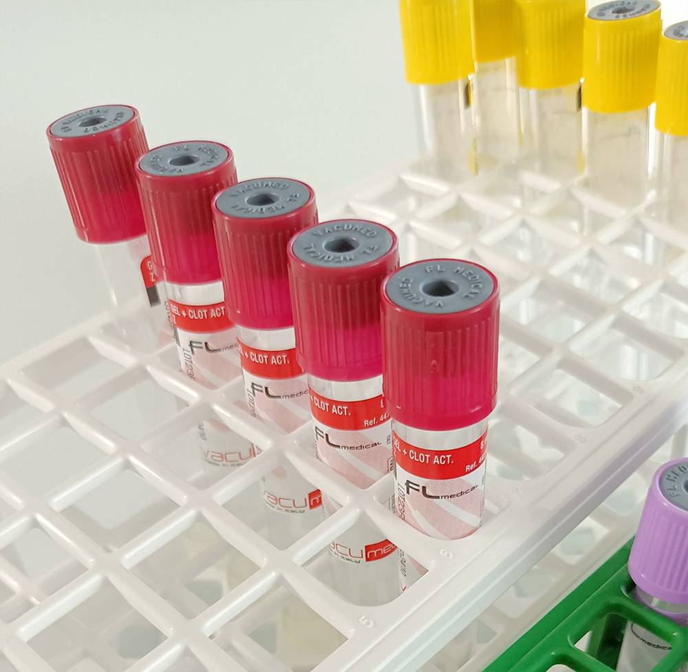portaprovette-fl-02 the perfect choice for laboratory needs