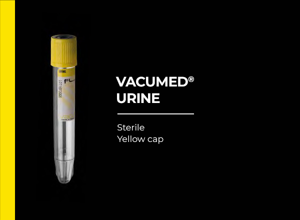 vacumed urine